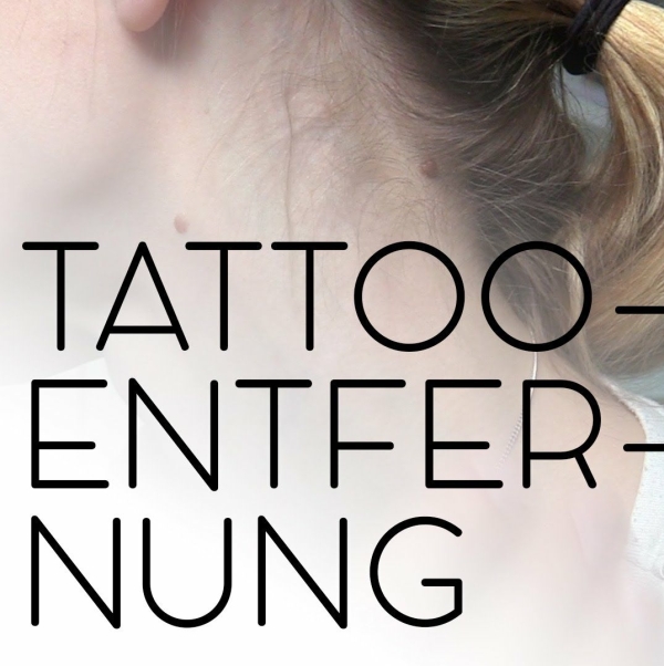 tattooentfernung knoop Logo